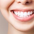 Should I get dental implants in Turkey?